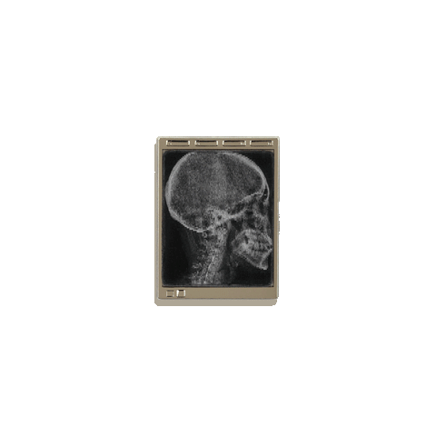 Radiology Light Box Enamel Pin by Rad Girl Creations